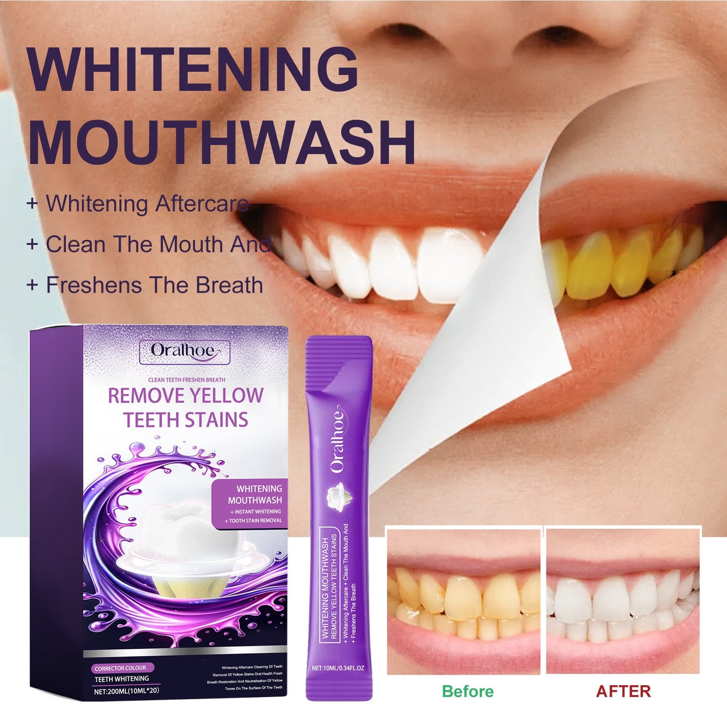 ORALHOE purple whitening mouthwash teeth cleaning yellow teeth stains whitening fresh breath oral care 