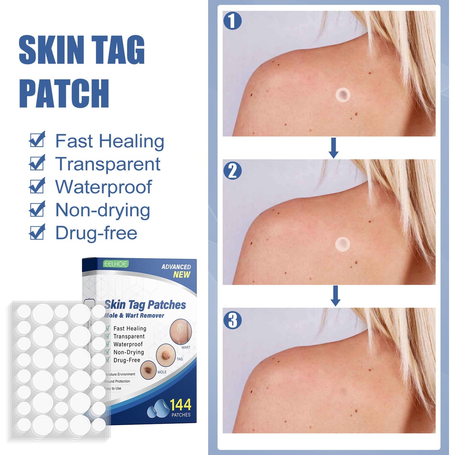 EELHOE wart patch corn patch wart mole mole cleansing care skin tag lightener patch 