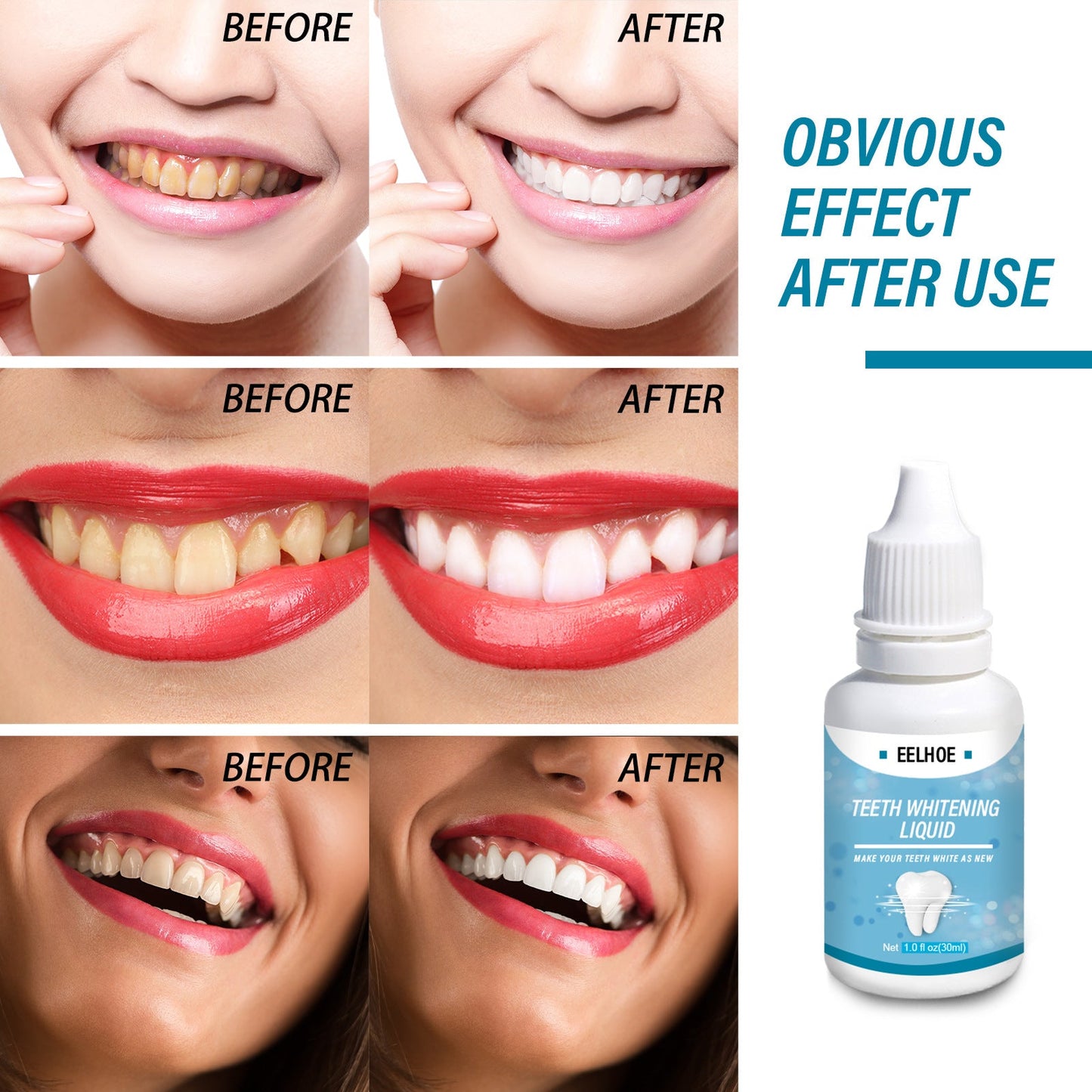 Teeth Whitening Liquid removes yellow teeth, black teeth, smoke-stained teeth, freshens breath, whitens and brightens 