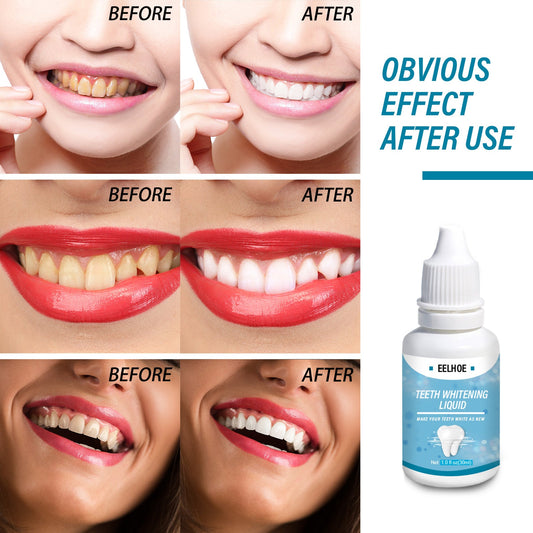 Teeth Whitening Liquid បំបាត់ធ្មេញលឿង ធ្មេញខ្មៅ ធ្មេញបារី ធ្វើអោយខ្យល់ដង្ហើមស្រស់ថ្លា និងធ្វើអោយធ្មេញភ្លឺ 