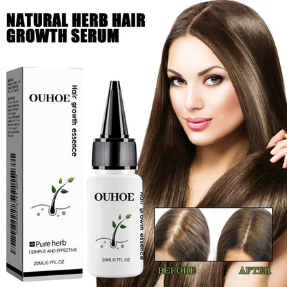 OUHOE Herbal Hair Essence Herbal Essence ផ្តល់សំណើមដល់សក់ ធ្វើអោយសក់រឹងមាំ ការពារសក់ជ្រុះ ព្យាបាលស្បែកក្បាល អោយសក់ក្រាស់ 