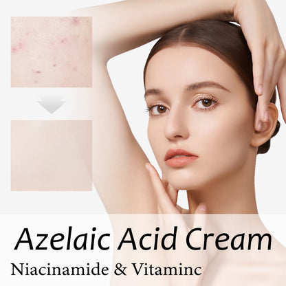 WIYUN Anti-acne Cream Deep Cleansing Moisturizing Facial Skin Lightens Acne Scars Blackhead Repair Cream 