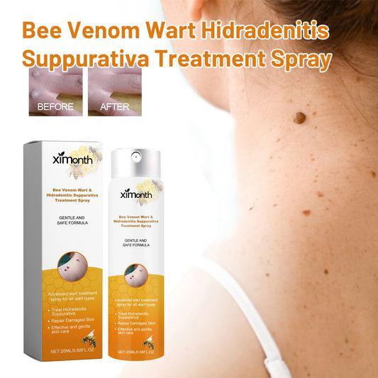 XIMONTH bee venom wart care spray skin cleansing repair fade black mole corn body care spray 