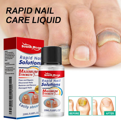 South Moon Nail Care Essence Thickening Onychomycosis Repair Repair Yellow Hand and Feet Moisturizing Care Solution 