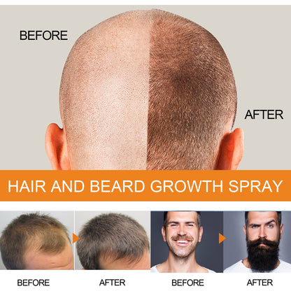 Jaysuing Hair Growth Spray បាញ់​ការពារ​សក់​បុរស និង​ពុក​ចង្កា​ដែល​ជួយ​ពង្រឹង​សក់ និង​ការពារ​ការ​ជ្រុះ​សក់។ 