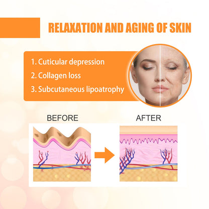 EELHOE collagen water-soluble nasolabial fold patch lightens fine lines nasolabial folds moisturizes and tightens the skin 