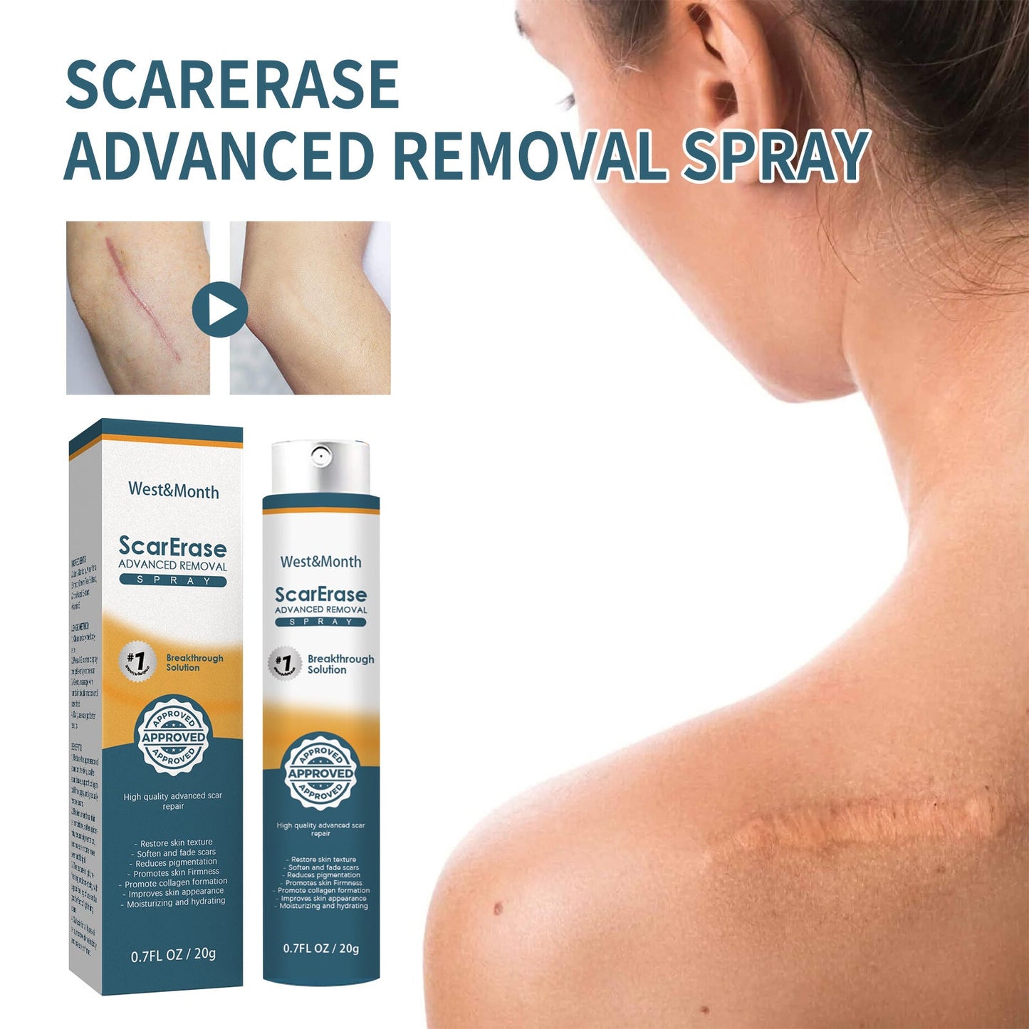 West&amp;Month Scar Repair Gel Lightens Skin Scars Repairs Acne Surgery Pregnancy Scars Smooths Skin 