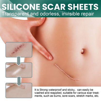 EELHOE Silicone Scar Patch ការ​ពពោះ​ការ​វះកាត់​វះកាត់​រលាក​ស្លាកស្នាម​ពណ៌​ដែល​មើល​មិន​ឃើញ បំណះ​ជួសជុល​ស្លាកស្នាម​ 