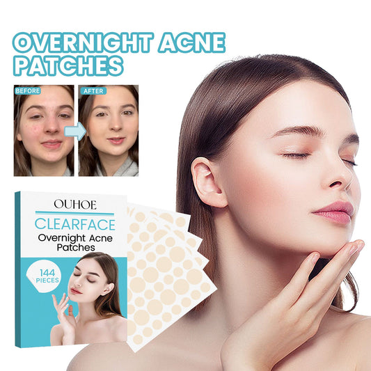 OUHOE acne patch lightens and cleanses acne, improves facial acne, closes the comedones, conceals, and breathable acne-clearing patches 