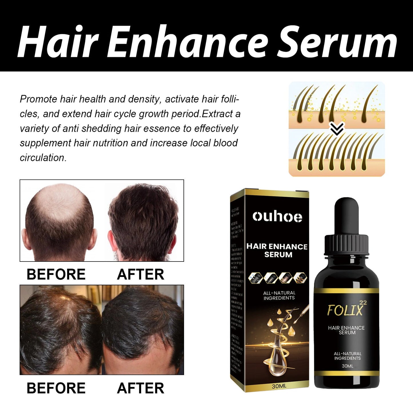 OUHOE hair care essential oil nourishes hair roots, strengthens hair, repairs damaged, dry and frizzy hair 