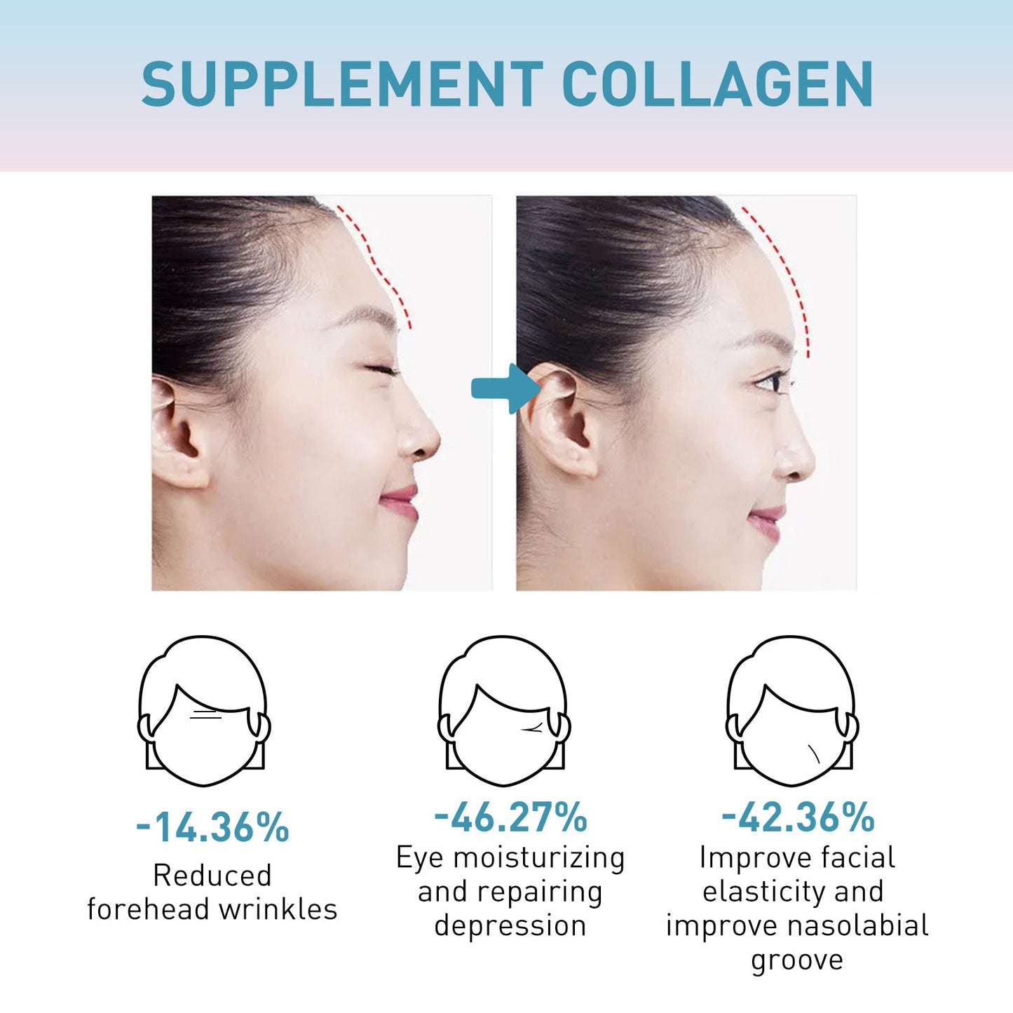 OUHOE Collagen Anti-Wrinkle Cream បំបាត់ស្នាមជ្រីវជ្រួញ ផ្តល់សំណើម បន្តឹងស្បែក ទន់រលោង និងប្រឆាំងភាពចាស់ 