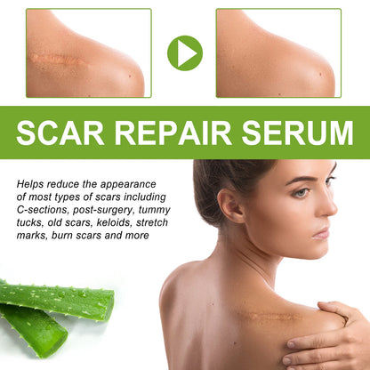 EELHOE Scar Repair Essence បំបាត់ស្លាកស្នាម ស្នាមមុន ស្នាមសង្វារពេលមានផ្ទៃពោះ ធ្វើអោយស្បែកទន់រលោង 