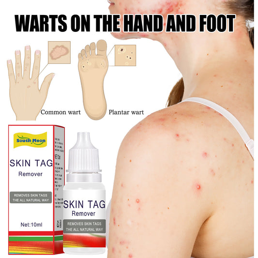 South Moon Pink Wart Liquid ធ្វើអោយស្បែកមុខ ស រលោង ជួសជុលស្បែក Calluses Mole Cleansing Care Liquid 