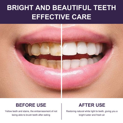 ORALHOE purple whitening mouthwash teeth cleaning yellow teeth stains whitening fresh breath oral care 