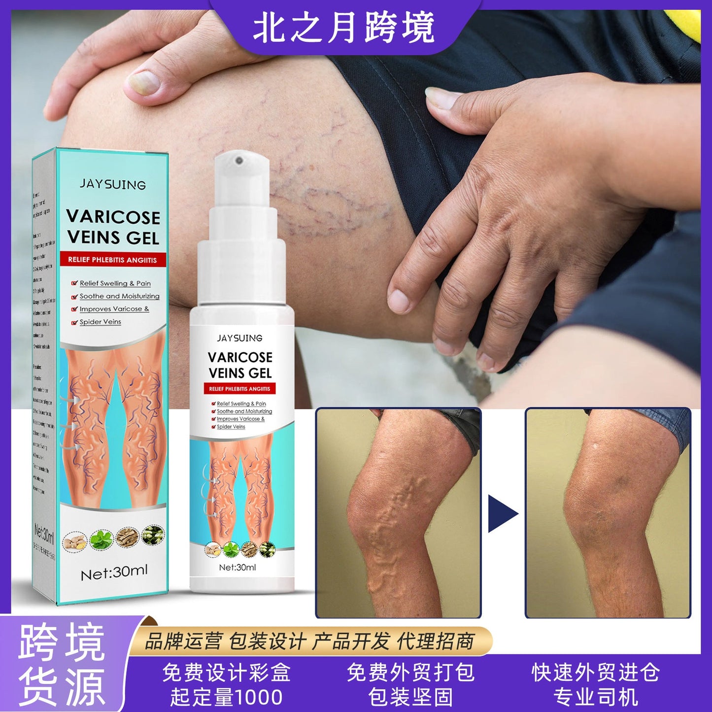 Jaysuing Varicose vein massage gel Pulse relief leg pain earthworm hamstring varicose vein gel 