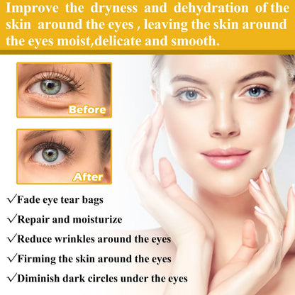 OUHOE vitamin E eye cream dilutes dark circles and crow's feet, lifts and tightens the skin around the eyes, hydrates and moisturizes 