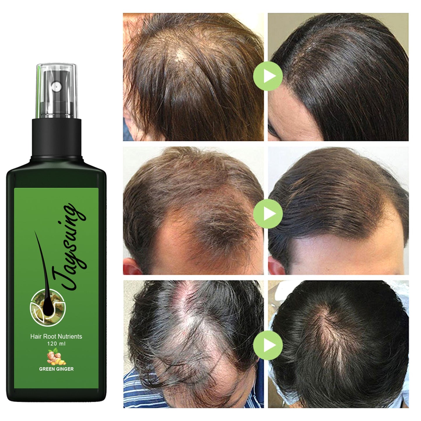 Jaysuing Hair Thickness Serum បណ្តុះសក់ ដុះក្រាស់ ចិញ្ចឹមឫសសក់ ពង្រឹងស្បែកក្បាល ម៉ាស្សា សារធាតុចិញ្ចឹម 