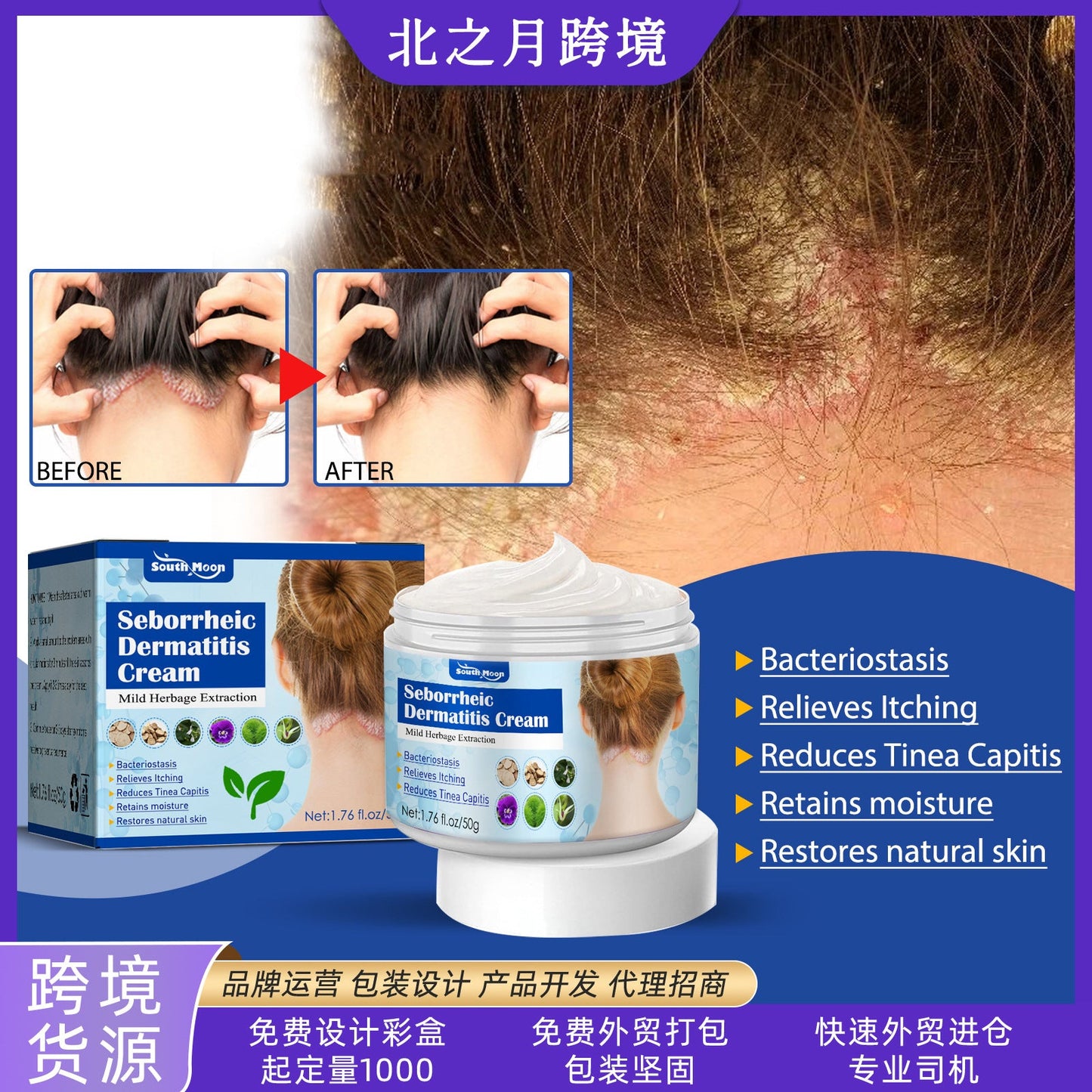 South moon seborrheic skin cream scalp ringworm head acne itching skin problem repair skin cream 