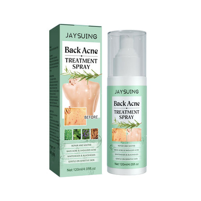 Jaysuing Back Acne Repair Spray Lightens Acne Scars Repairs Back Shoulders Body Cleansing Smooth Skin 