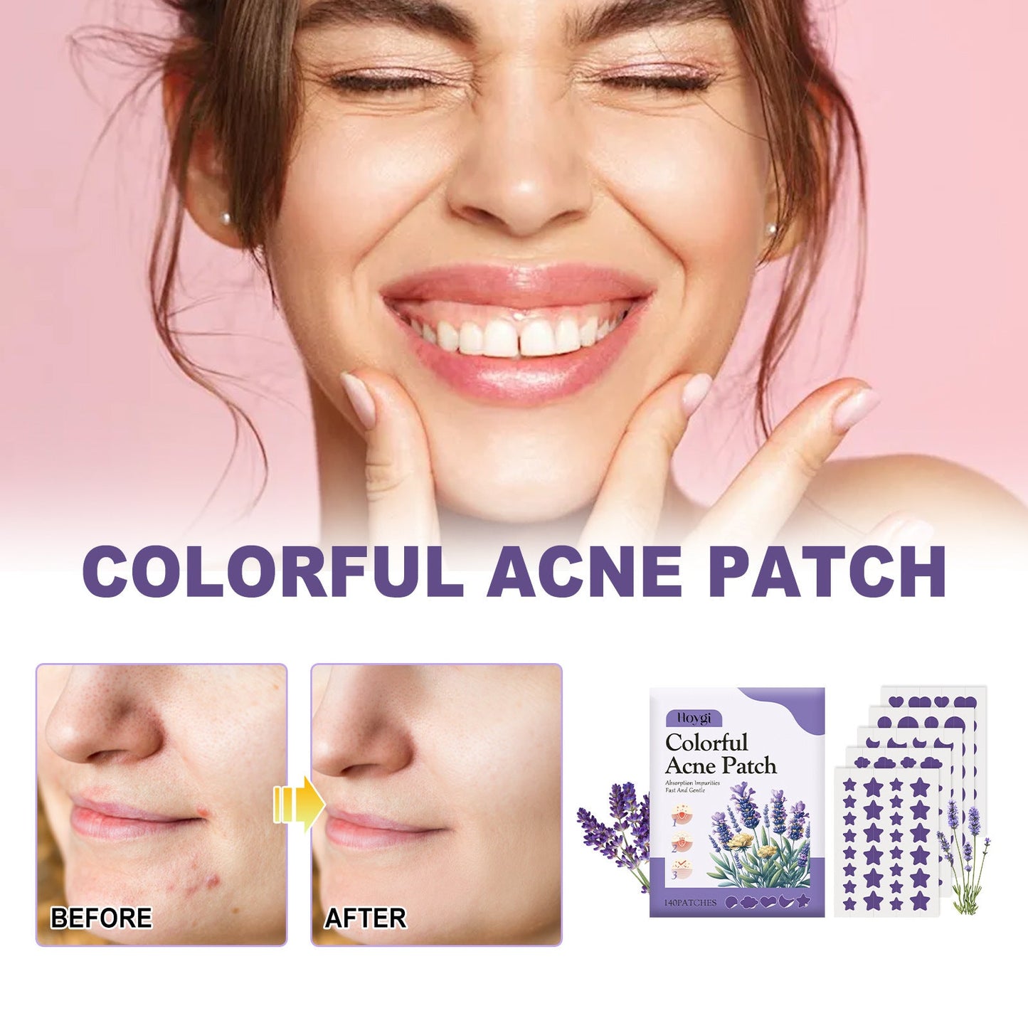 Hoygi Purple Acne Patch ជួសជុលស្នាមមុន បិទមាត់ ទន់រលោង មិនរមាស់ស្បែក 