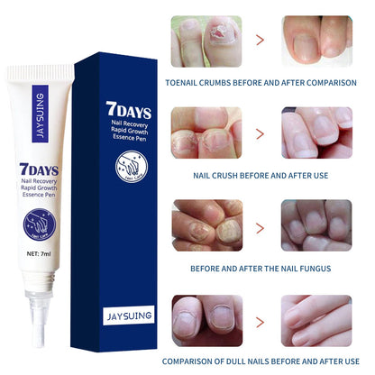 Jaysuing 7-day nail repair essence liquid hand and foot nail care rotten toenails bright nails onychomycosis repair liquid 