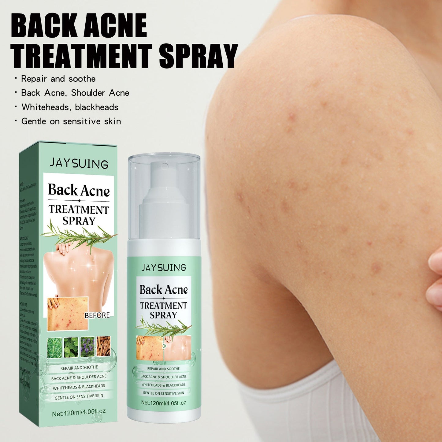 Jaysuing Back Acne Repair Spray បំបាត់ស្នាមមុន ជួសជុលខ្នង ស្មា និងដងខ្លួន សម្អាត និងធ្វើអោយស្បែករលោង 