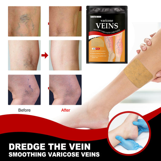 South Moon Vein Health Patch បំបាត់សរសៃ varicose ដែលស្ទះនៅជើង និងលើកបំណះសុខភាពសរសៃវ៉ែនត្រជាក់ 