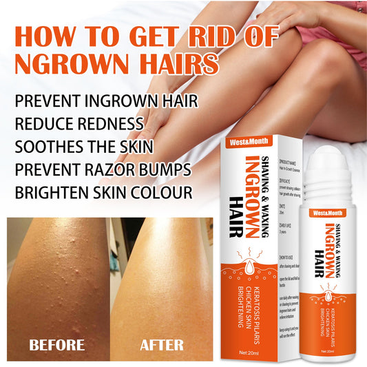 West&amp;Month Anti-Ingrown Hair Serum Anti-Shaving Bumps Ingrown Hair Serum After Shaving 