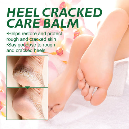 OUHOE Cracked Heel Care Cream Repair Heel Peeling, ការពារជើងស្ងួត និងប្រេះ, Moisturizing Care Cream 