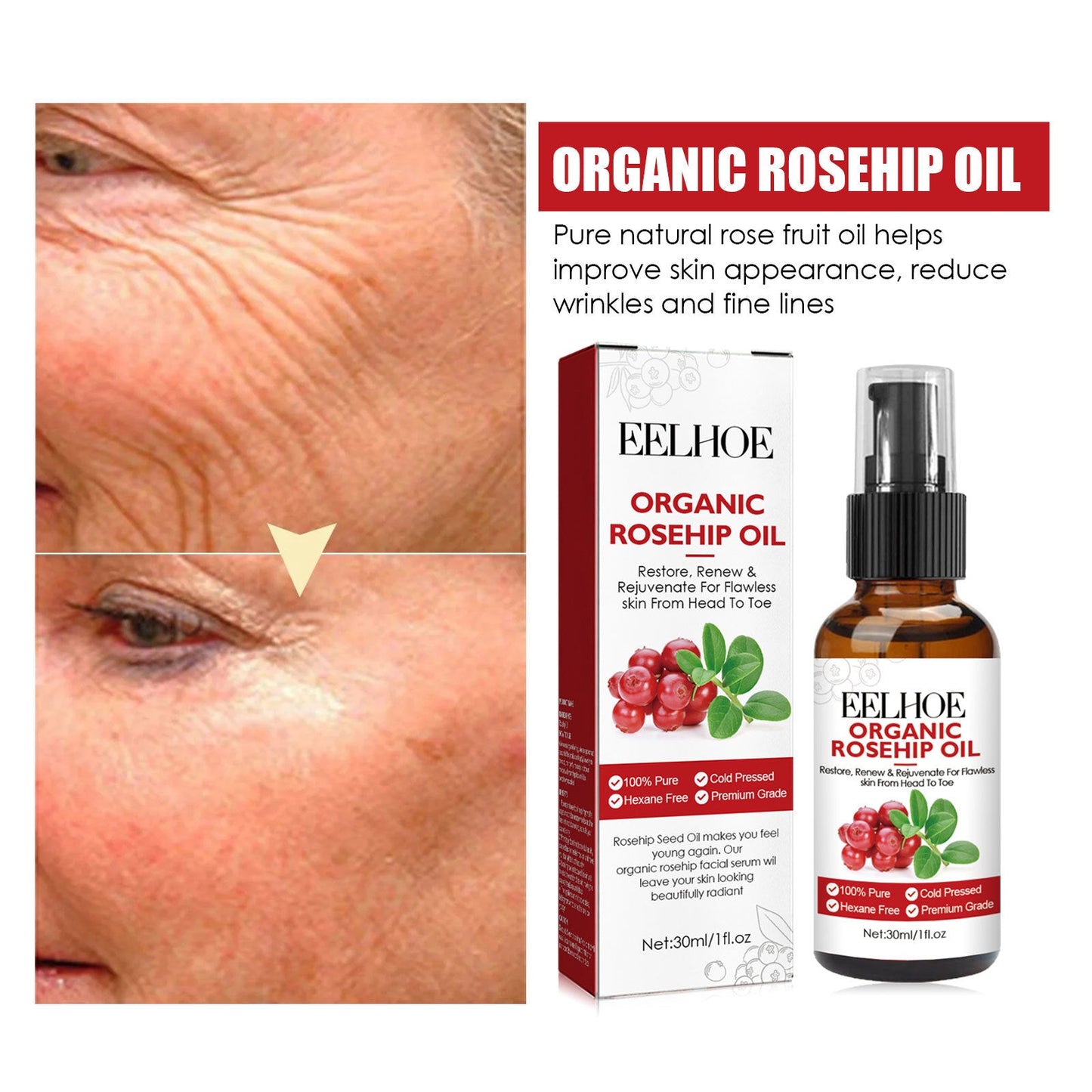 EELHOE Rosehip Oil Facial Essence ផ្តល់សំណើម កាត់បន្ថយស្នាមជ្រួញ បង្រួមរន្ធញើស ប្រឆាំងភាពចាស់ 