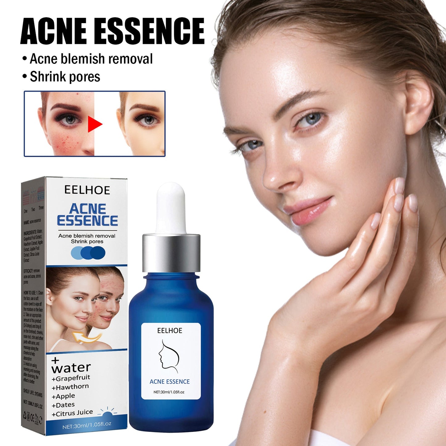 EELHOE Little Blue Bottle Anti-Acne Essence បំបាត់មុន និងស្នាមមុន ផ្តល់សំណើម បង្រួមរន្ធញើស ជួសជុល Essence 