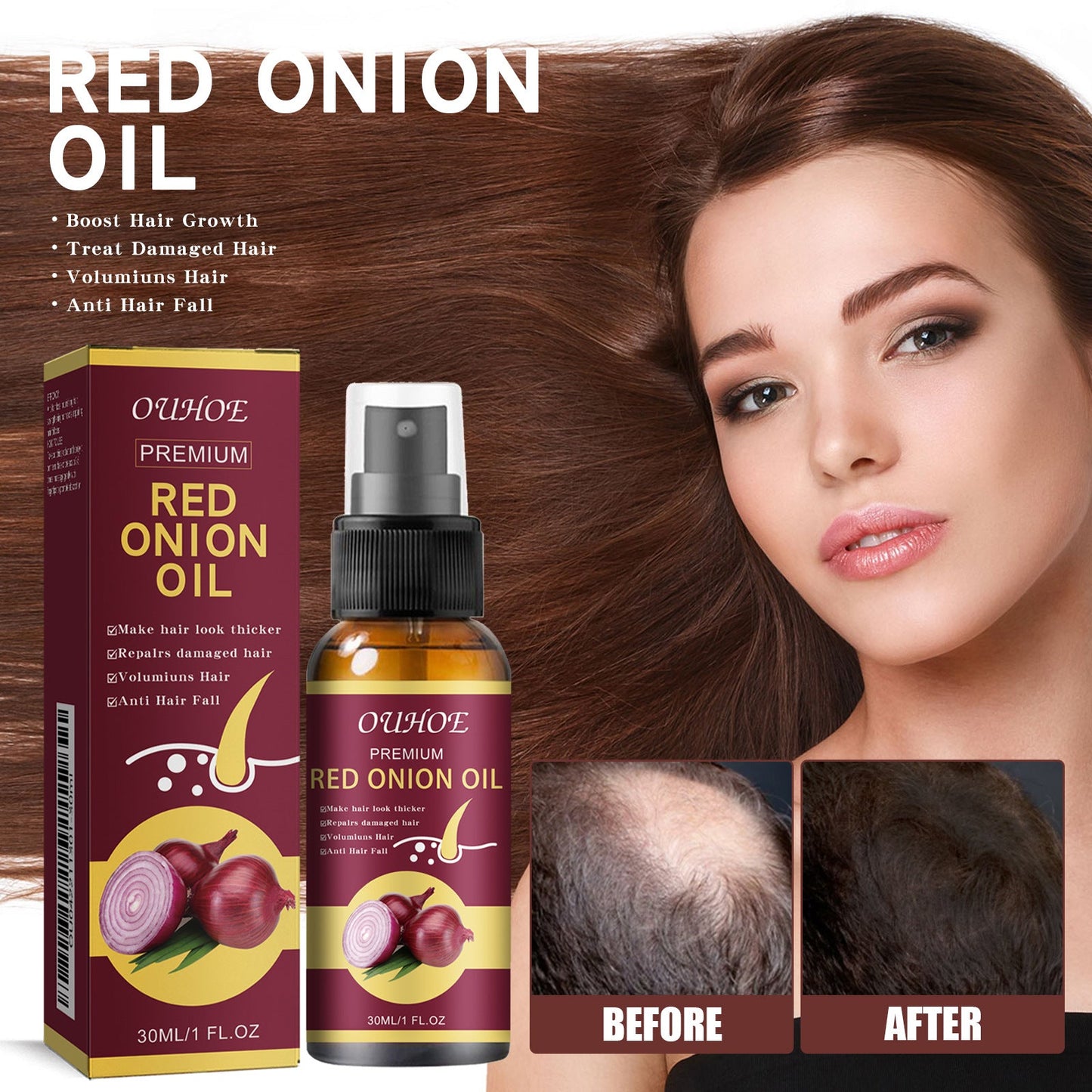 OUHOE Onion Hair Oil Thickening, Softening, Strong, Anti-hair Loss, Nourishing, Hair Care Spray 