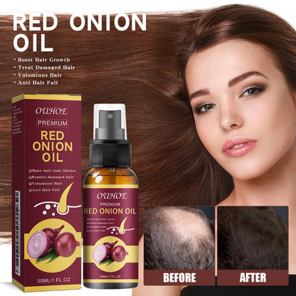 OUHOE onion thick hair oil Essential oil ក្រាស់ រលោង រឹងមាំ ប្រឆាំងការជ្រុះសក់ ស្ព្រាយផ្តល់សំណើមដល់សក់ 