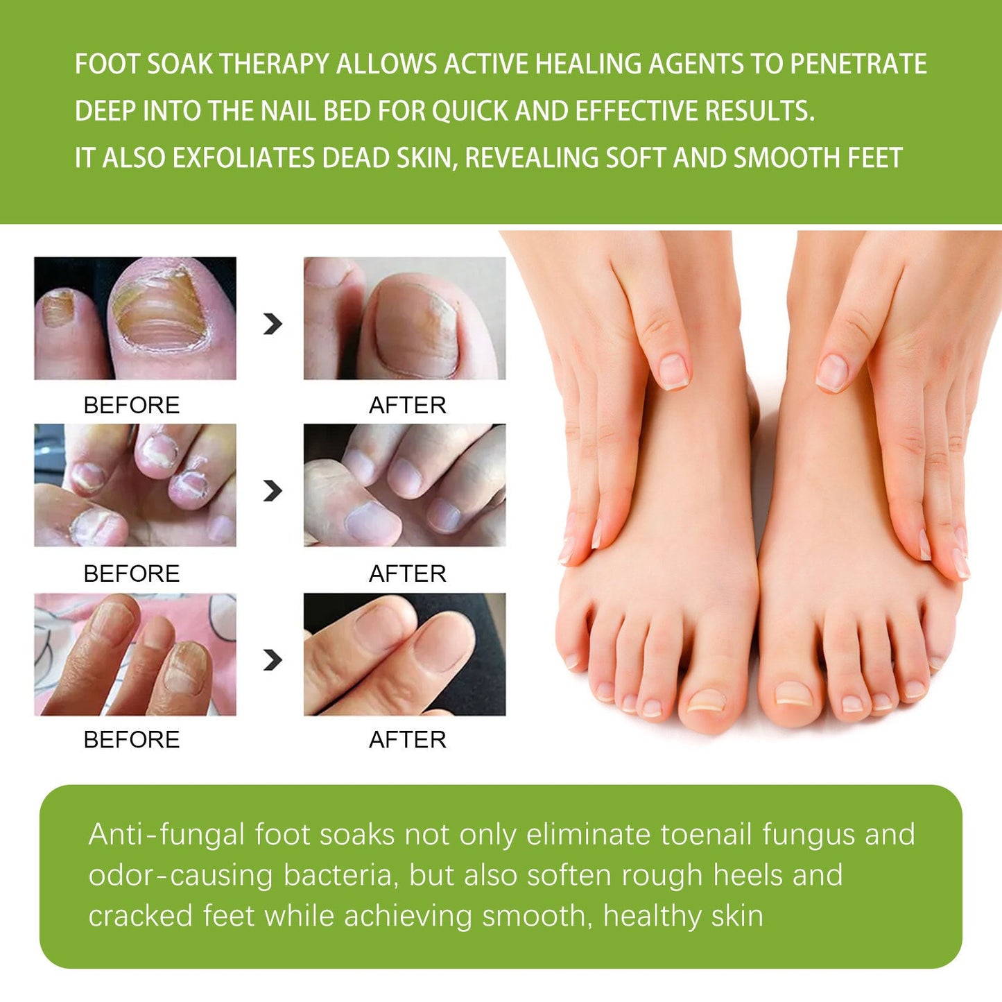 West&amp;Month Ginger Foot Bath Tablets for Onychomycosis Repair, Polishing and Deodorizing Foot Care Foot Bath Tablets 