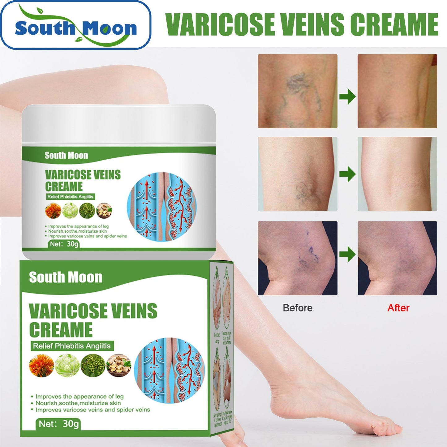 South Moon Varicose Repair Cream Legs Earthworms Leg Veins Relief Pain Leg Care Massage Cream 