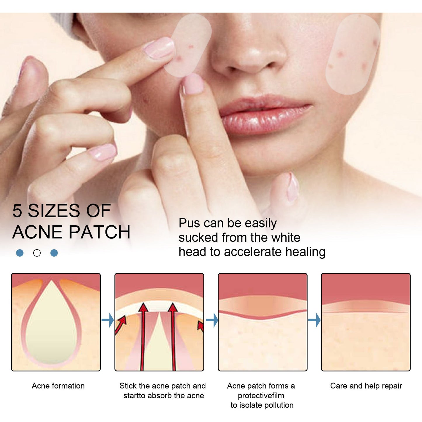 EELHOE acne patch invisible acne patch anti-acne closed comedones waterproof makeup concealer hydrocolloid oil acne patch 