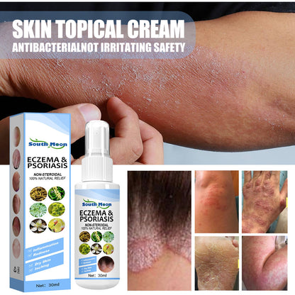 South Moon skin repair spray, psoriasis psoriasis skin external use athlete's foot spray skin antibacterial spray 