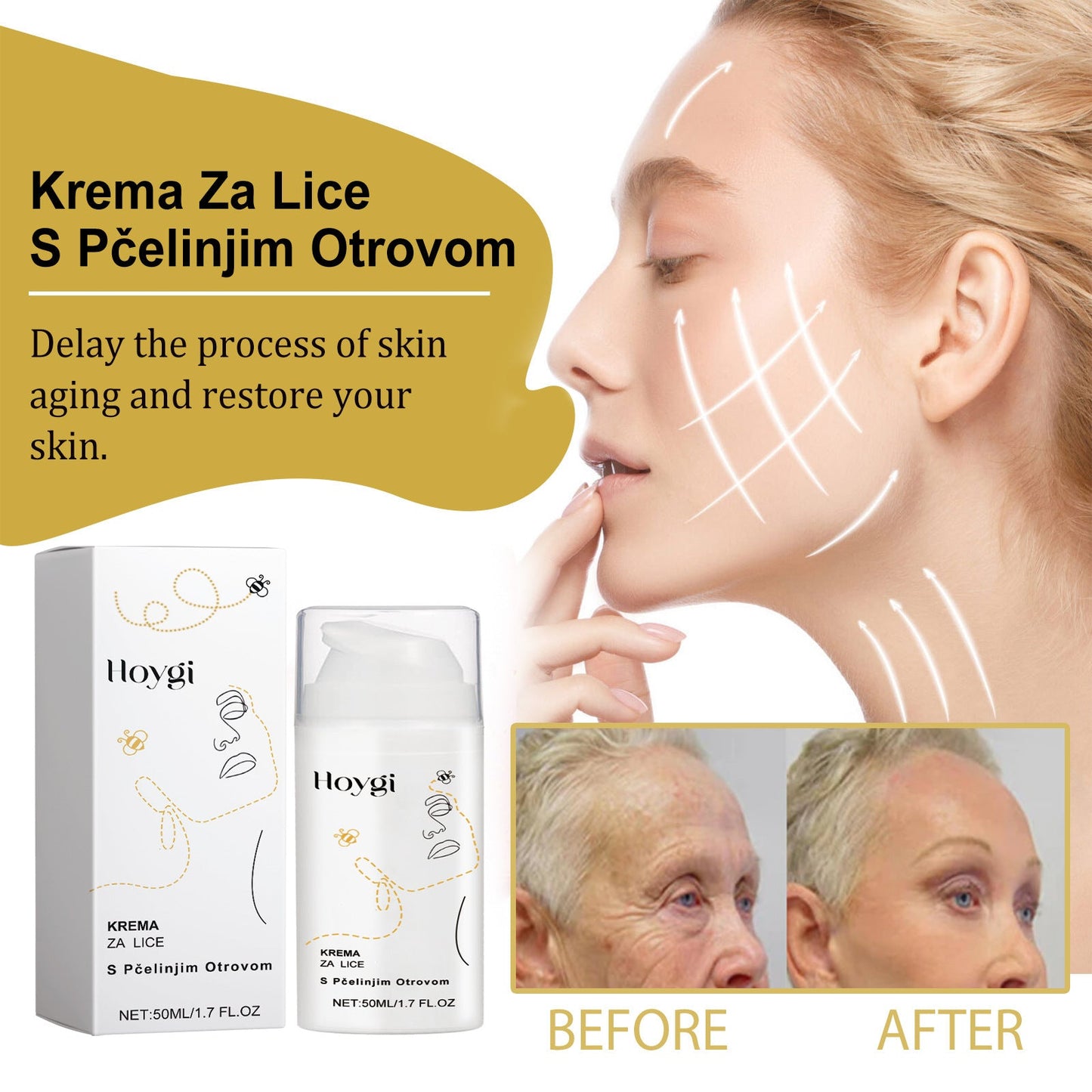 Hoygi Bee Venom Cream Lightens Fine Lines and Nasal Lines Moisturizes and Firms Skin Brightens and Anti-Wrinkle Cream 