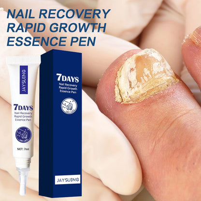 Jaysuing 7-Day Nail Repair Essence Hand and Foot Nail Care Broken Toenails Brightening Nails Onychomycosis Nail Repair Solution 