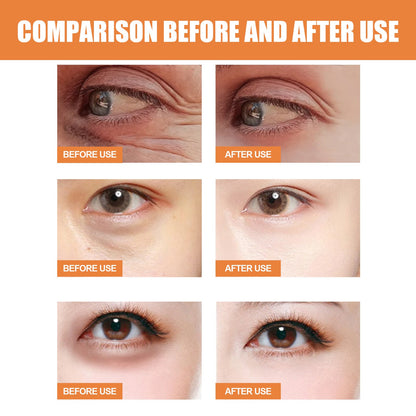 EELHOE vitamin C eye cream stick fades eye bags, fine lines at the corners of the eyes, crow's feet, firming the skin and moisturizing eye cream stick 