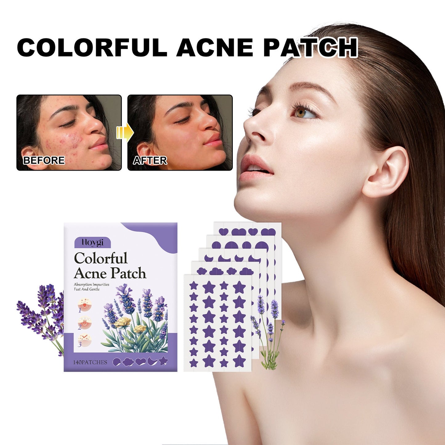 Hoygi purple acne patch repairs acne and blackheads, mild and non-irritating, smooth skin, acne-clearing patch 