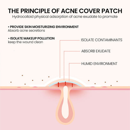 Jaysuing Acne Patch Series Repair, Cleaning, Close, Gentle and Fading Acne Balancing Skin Acne Patch 