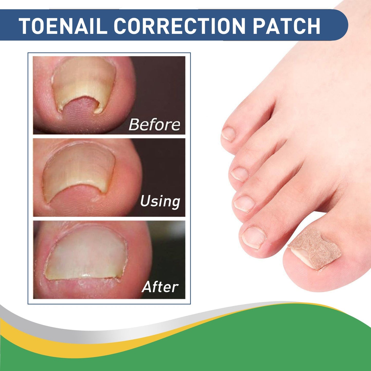 Jaysuing Toenail Groove Correction Stickers Toe Ingrown Nails Correction Pull-Up Stickers Nail Repair Stickers Nail Art 