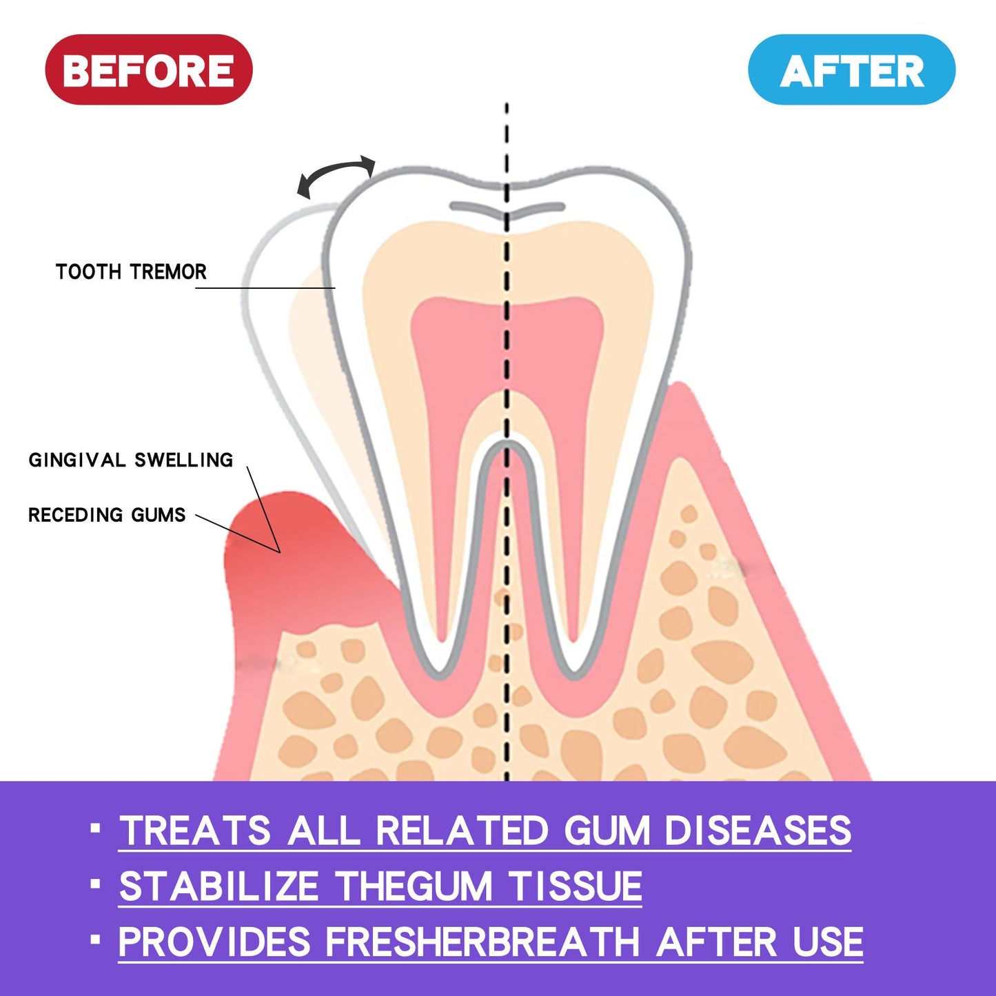 EELHOE gum foam mousse cares for gums, deeply cleans teeth dirt, cleans teeth and protects teeth mousse toothpaste 