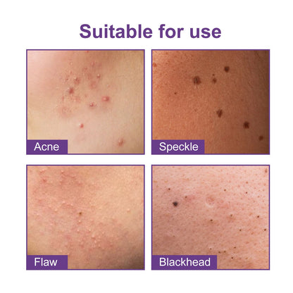 Jaysuing Acne Patch Fading Closed Pimples Clearing Acne Waterproof Breathable Repair Acne Skin Pattern Acne Patch 