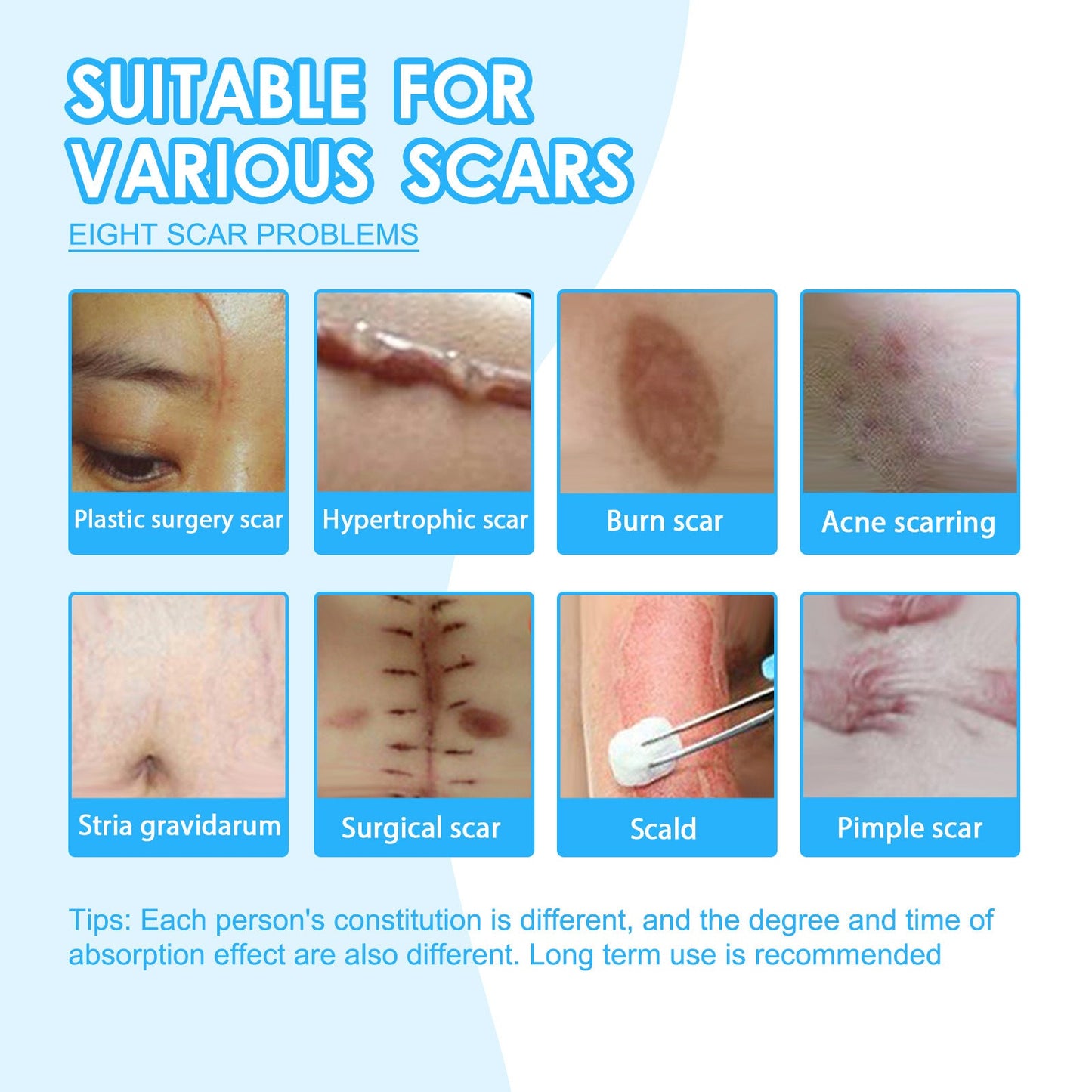 EELHOE scar removal cream repairs the skin, fades scars, smoothes the skin, removes scars from pregnancy and surgery 