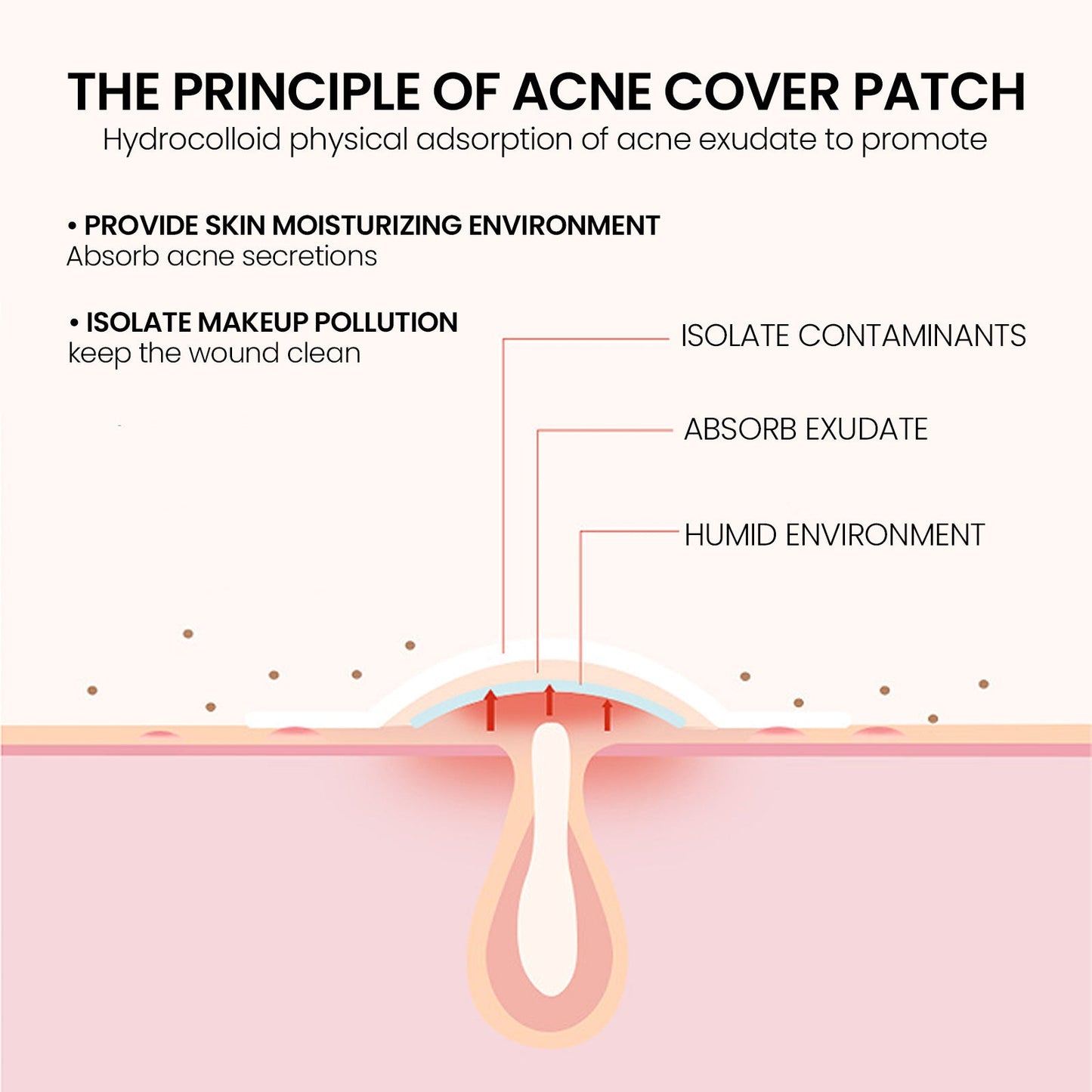 Jaysuing Acne Patch បំបាត់ស្នាមអុចខ្មៅ ជួសជុលស្នាមមុន និងស្នាមជាំ បិទបាំងស្នាមមុន 