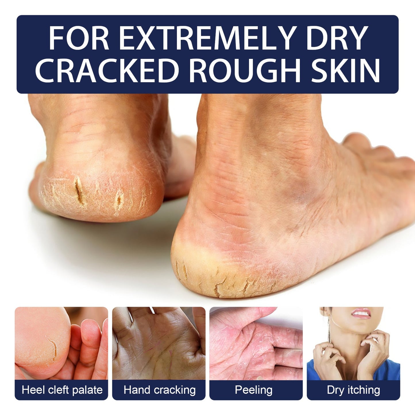 Jaysuing Anti-crack Repair Hand Cream Exfoliates to Improve Cracked and Rough Skin Moisturizing Hand and Foot Cream 