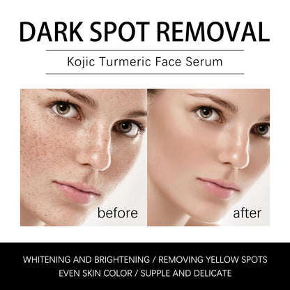 Jaysuing dark spot removal facial essence fades spots and spots to remove melanin and brighten skin tone. 