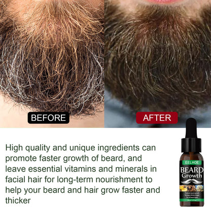 EELHOE Beard Growth Oil Nourishing Moisturizing Spray Beard Care ជួយជំរុញការលូតលាស់ពុកចង្ការ និងធ្វើអោយអង្គធាតុរាវកាន់តែក្រាស់ 